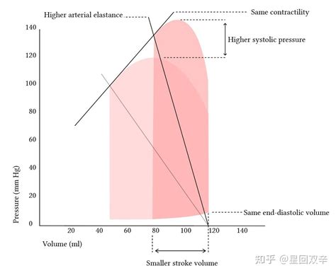 lv 银包推介